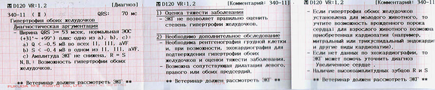 электрокардиограмма электрокардиограмма
